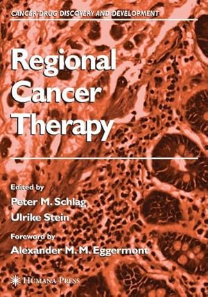 Immagine del venditore per Regional Cancer Therapy venduto da AHA-BUCH GmbH