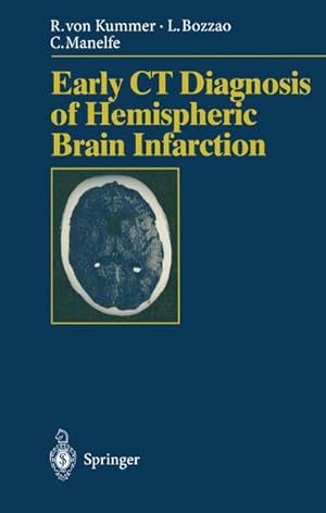 Seller image for Early CT Diagnosis of Hemispheric Brain Infarction for sale by AHA-BUCH GmbH