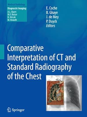 Immagine del venditore per Comparative Interpretation of CT and Standard Radiography of the Chest venduto da AHA-BUCH GmbH