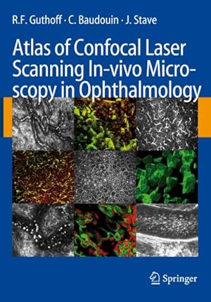 Imagen del vendedor de Atlas of Confocal Laser Scanning In-vivo Microscopy in Ophthalmology a la venta por AHA-BUCH GmbH
