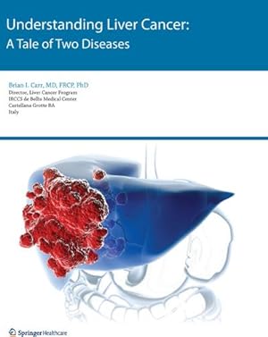 Bild des Verkufers fr Understanding Liver Cancer : A Tale of Two Diseases zum Verkauf von AHA-BUCH GmbH