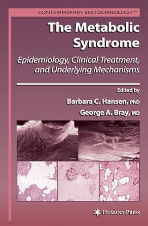 Seller image for The Metabolic Syndrome: : Epidemiology, Clinical Treatment, and Underlying Mechanisms for sale by AHA-BUCH GmbH