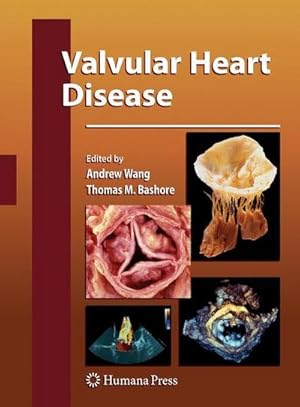 Image du vendeur pour Valvular Heart Disease mis en vente par AHA-BUCH GmbH