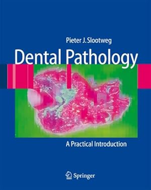 Bild des Verkufers fr Dental Pathology : A Practical Introduction zum Verkauf von AHA-BUCH GmbH