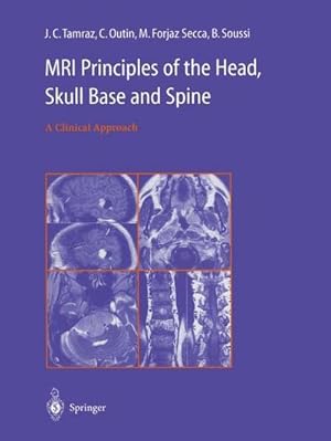 Seller image for MRI Principles of the Head, Skull Base and Spine : A Clinical Approach for sale by AHA-BUCH GmbH