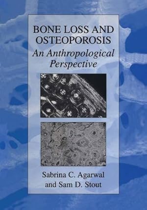 Immagine del venditore per Bone Loss and Osteoporosis : An Anthropological Perspective venduto da AHA-BUCH GmbH