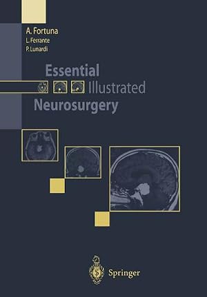 Bild des Verk�ufers f�r Essential Illustrated Neurosurgery zum Verkauf von AHA-BUCH GmbH