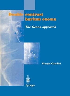 Bild des Verkufers fr Double contrast barium enema : The Genoa approach zum Verkauf von AHA-BUCH GmbH