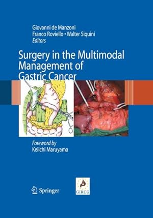 Imagen del vendedor de Surgery in the Multimodal Management of Gastric Cancer a la venta por AHA-BUCH GmbH