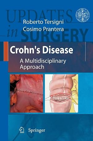 Imagen del vendedor de Crohn's Disease : A Multidisciplinary Approach a la venta por AHA-BUCH GmbH