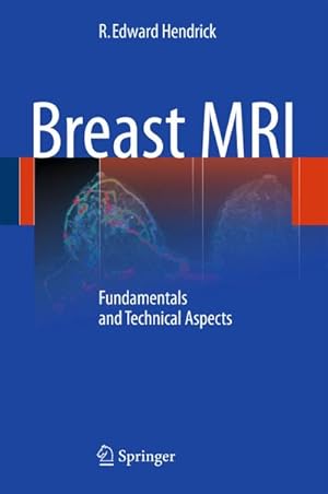 Image du vendeur pour Breast MRI : Fundamentals and Technical Aspects mis en vente par AHA-BUCH GmbH