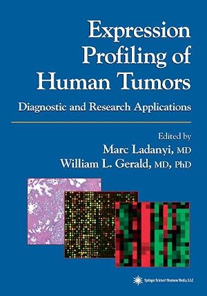 Immagine del venditore per Expression Profiling of Human Tumors : Diagnostic and Research Applications venduto da AHA-BUCH GmbH