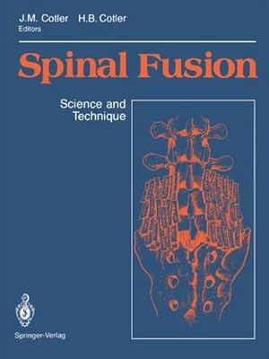 Immagine del venditore per Spinal Fusion : Science and Technique venduto da AHA-BUCH GmbH