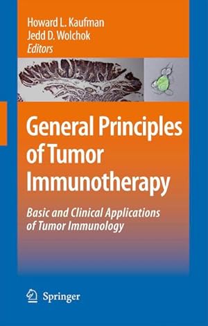 Bild des Verk�ufers f�r General Principles of Tumor Immunotherapy : Basic and Clinical Applications of Tumor Immunology zum Verkauf von AHA-BUCH GmbH
