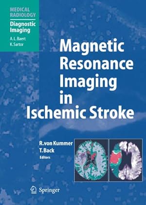 Seller image for Magnetic Resonance Imaging in Ischemic Stroke for sale by AHA-BUCH GmbH