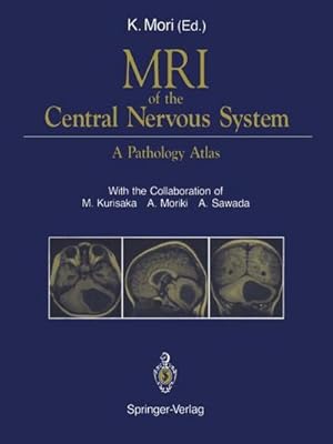 Seller image for MRI of the Central Nervous System : A Pathology Atlas for sale by AHA-BUCH GmbH