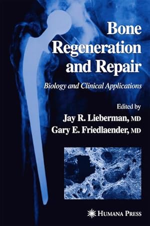 Bild des Verkufers fr Bone Regeneration and Repair : Biology and Clinical Applications zum Verkauf von AHA-BUCH GmbH