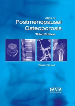 Bild des Verkufers fr Atlas of Postmenopausal Osteoporosis : Third Edition zum Verkauf von AHA-BUCH GmbH