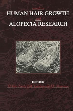 Image du vendeur pour Trends in Human Hair Growth and Alopecia Research mis en vente par AHA-BUCH GmbH