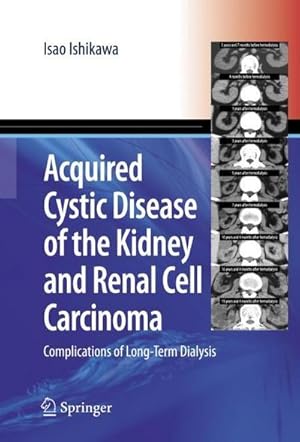 Image du vendeur pour Acquired Cystic Disease of the Kidney and Renal Cell Carcinoma : Complication of Long-Term Dialysis mis en vente par AHA-BUCH GmbH