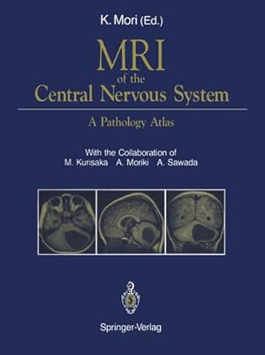 Seller image for MRI of the Central Nervous System : A Pathology Atlas for sale by AHA-BUCH GmbH