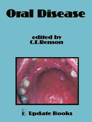 Seller image for Oral Disease for sale by AHA-BUCH GmbH