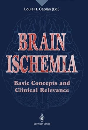 Bild des Verkufers fr Brain Ischemia : Basic Concepts and Clinical Relevance zum Verkauf von AHA-BUCH GmbH