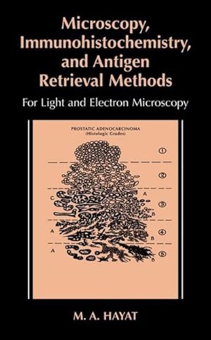 Bild des Verkufers fr Microscopy, Immunohistochemistry, and Antigen Retrieval Methods : For Light and Electron Microscopy zum Verkauf von AHA-BUCH GmbH