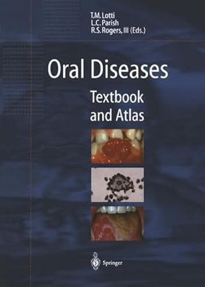 Bild des Verkufers fr Oral Diseases : Textbook and Atlas zum Verkauf von AHA-BUCH GmbH