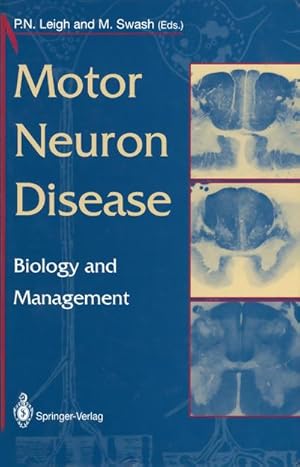 Imagen del vendedor de Motor Neuron Disease : Biology and Management a la venta por AHA-BUCH GmbH