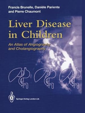Seller image for Liver Disease in Children : An Atlas of Angiography and Cholangiography for sale by AHA-BUCH GmbH