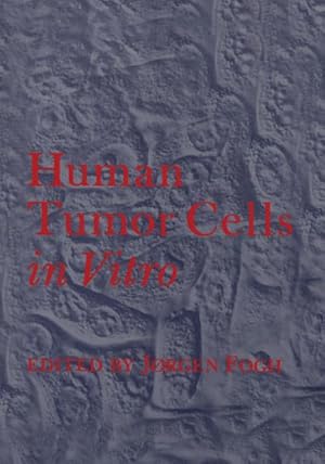 Seller image for Human Tumor Cells in Vitro for sale by AHA-BUCH GmbH