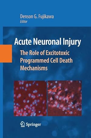 Bild des Verkufers fr Acute Neuronal Injury : The Role of Excitotoxic Programmed Cell Death Mechanisms zum Verkauf von AHA-BUCH GmbH