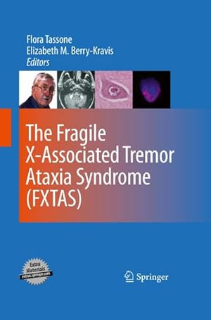 Bild des Verkufers fr The Fragile X-Associated Tremor Ataxia Syndrome (FXTAS) zum Verkauf von AHA-BUCH GmbH