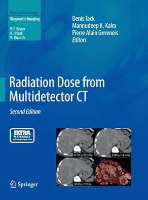 Seller image for Radiation Dose from Multidetector CT for sale by AHA-BUCH GmbH