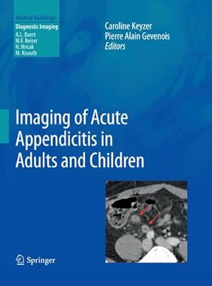 Seller image for Imaging of Acute Appendicitis in Adults and Children for sale by AHA-BUCH GmbH