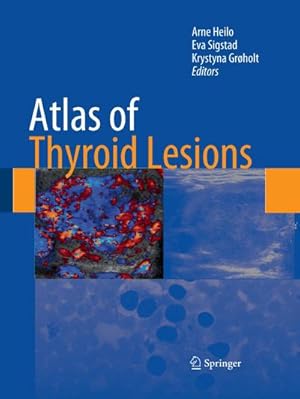 Immagine del venditore per Atlas of Thyroid Lesions venduto da AHA-BUCH GmbH