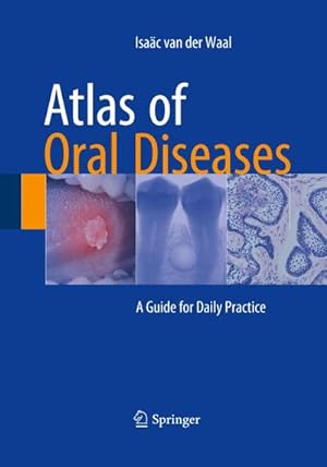 Bild des Verkufers fr Atlas of Oral Diseases : A Guide for Daily Practice zum Verkauf von AHA-BUCH GmbH