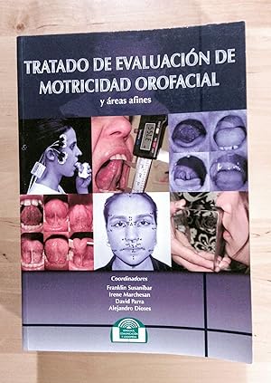 Bild des Verkufers fr Tratado de Evaluacin de Motricidad Orofacial y reas afines zum Verkauf von Llibres Bombeta