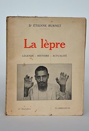 Bild des Verkufers fr La Lpre : Lgende - Histoire - Actualit zum Verkauf von Librairie Raimbeau