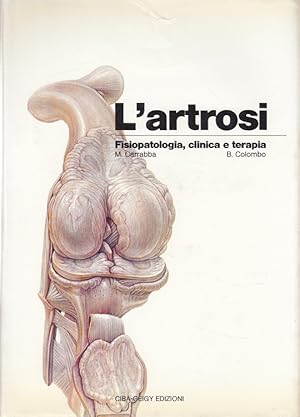 Seller image for L'artrosi. Fisiopatologia, clinica e terapia for sale by Versandantiquariat Nussbaum