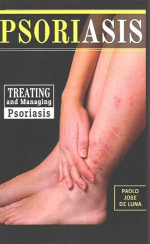 Image du vendeur pour Psoriasis : Treating and Managing Psoriasis mis en vente par GreatBookPrices