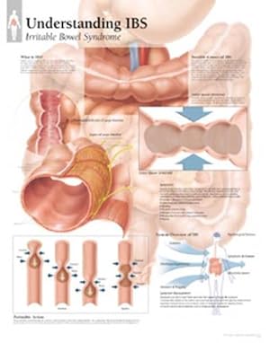 Seller image for Understanding IBS Laminated Poster (Paperback) for sale by Grand Eagle Retail