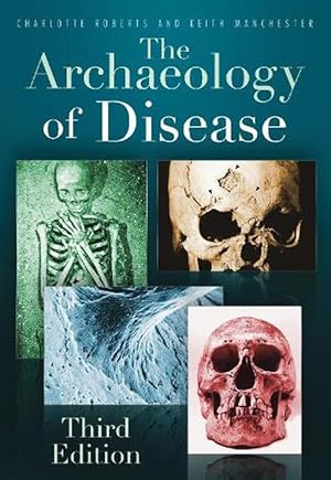 Seller image for The Archaeology of Disease (Paperback) for sale by Grand Eagle Retail