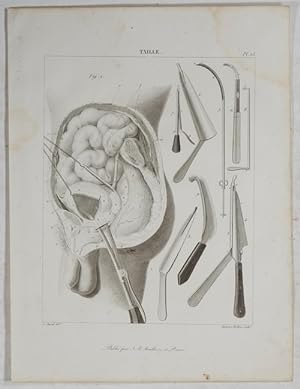 Bild des Verkufers fr Taille. A. Chazal del.; Ambroise Tardieu sculp. zum Verkauf von Antiq. F.-D. Shn - Medicusbooks.Com