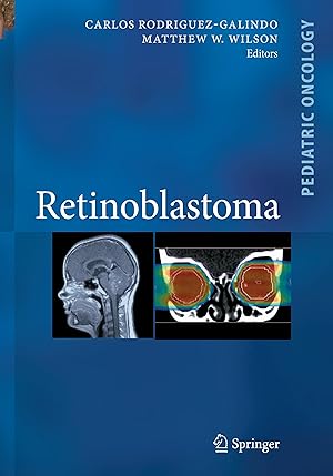 Seller image for Retinoblastoma for sale by moluna