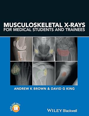 Bild des Verkufers fr Musculoskeletal X-Rays for Medical Students zum Verkauf von moluna