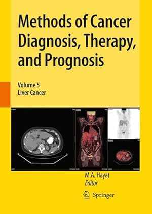 Seller image for Methods of Cancer Diagnosis, Therapy, and Prognosis for sale by moluna