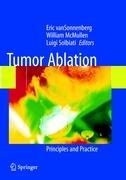 Seller image for Tumor Ablation for sale by moluna