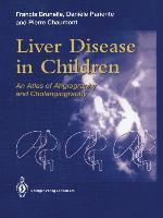 Seller image for Liver Disease in Children for sale by moluna